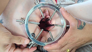 I HAD MY ASSHOLE TORN APART WITH AN ANAL DILATOR BY MY BEST FRIEND MY HUSBAND'S WIFE