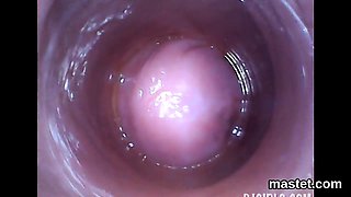 Kinky czech girl stretches her juicy cunt to the special03zU