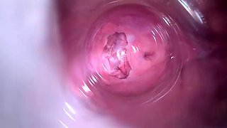 Camera deep inside teen Mias tight pussy