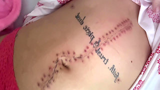 Scar Fetishes Stitches Staples Hospital Recovery After Surgery Teen Petite Small Waist