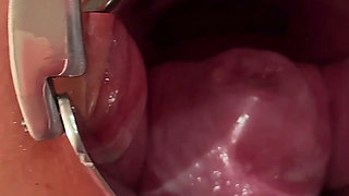Masked Schoolgirl Extreme Cervix View and Double Vaginal Fisting