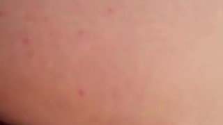 anal-